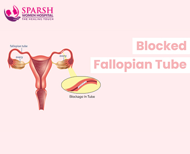 Blocked Fallopian Tubes Symptoms Causes And Treatment