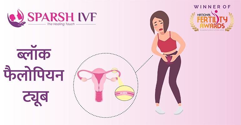 फैलोपियन ट्यूब ब्लॉकेज, फैलोपियन ट्यूब ब्लॉकेज इलाज, फैलोपियन ट्यूब ब्लॉकेज खर्चा, फैलोपियन ट्यूब ब्लॉकेज लक्षण, फैलोपियन ट्यूब ब्लॉकेज जांच, फैलोपियन ट्यूब ब्लॉकेज उपचार फैलोपियन ट्यूब ब्लॉकेज, फैलोपियन ट्यूब ब्लॉकेज इलाज, फैलोपियन ट्यूब ब्लॉकेज खर्चा, फैलोपियन ट्यूब ब्लॉकेज लक्षण, फैलोपियन ट्यूब ब्लॉकेज जांच, फैलोपियन ट्यूब ब्लॉकेज उपचार