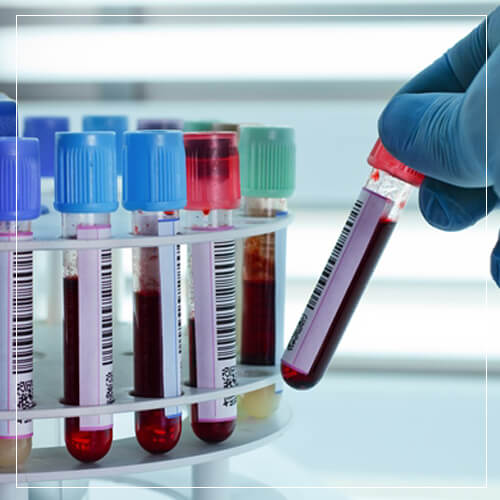 Hematology