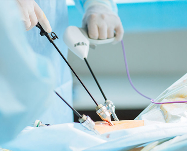 Best Laparoscopy Surgeon in Udaipur